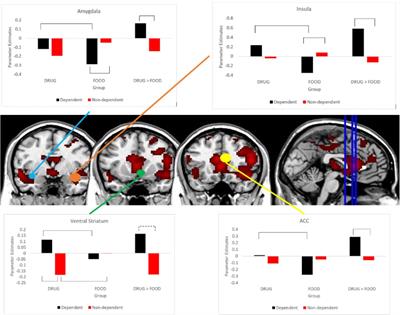 Neuroimaging Metrics of Drug and Food Processing in Cocaine-Dependence, as a Function of Psychopathic Traits and Substance Use Severity